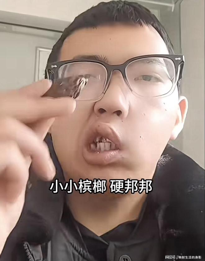 年导致脸部变形还边嚼边劝大家别碰槟榔long8唯一中国网站男子嚼槟榔七(图3)