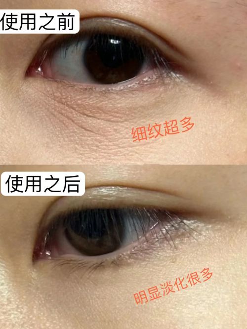 强！2025年最新眼霜排行评分榜单龙8游戏国际登录抗皱眼霜排行榜前十(图8)