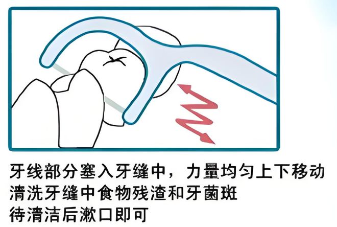 卫生习惯--小鹿妈妈牙线龙8国际唯一年夜饭后的(图3)